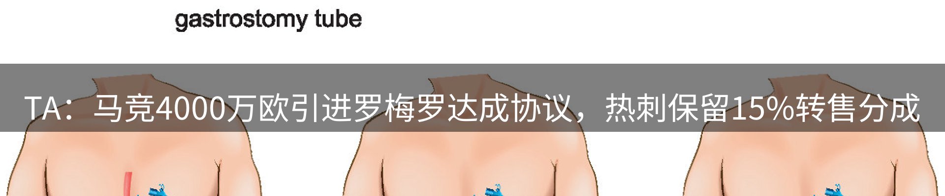 焦点汇聚